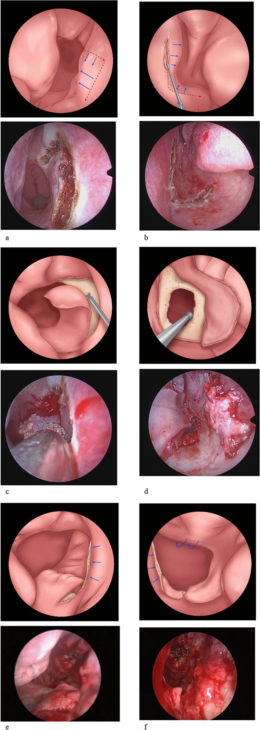 Fig. 3