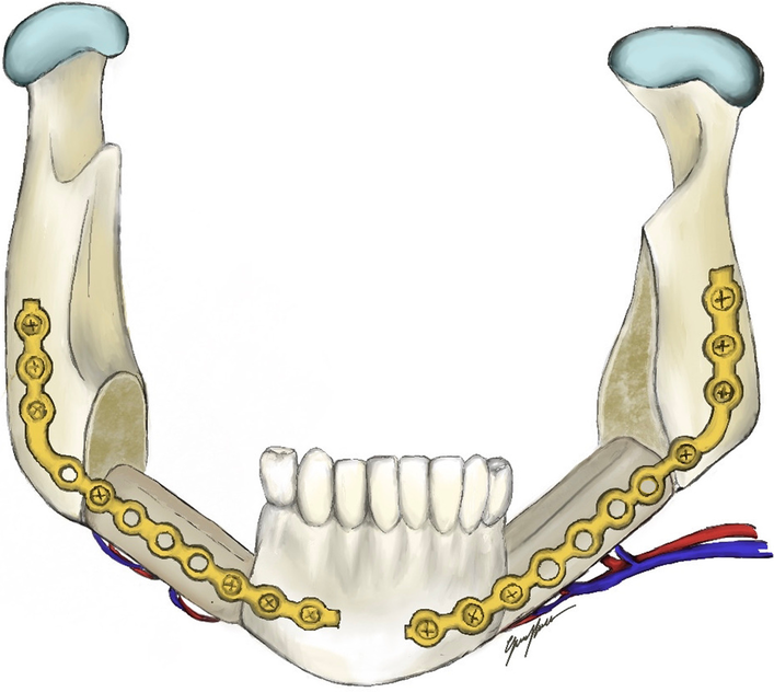 Fig. 7