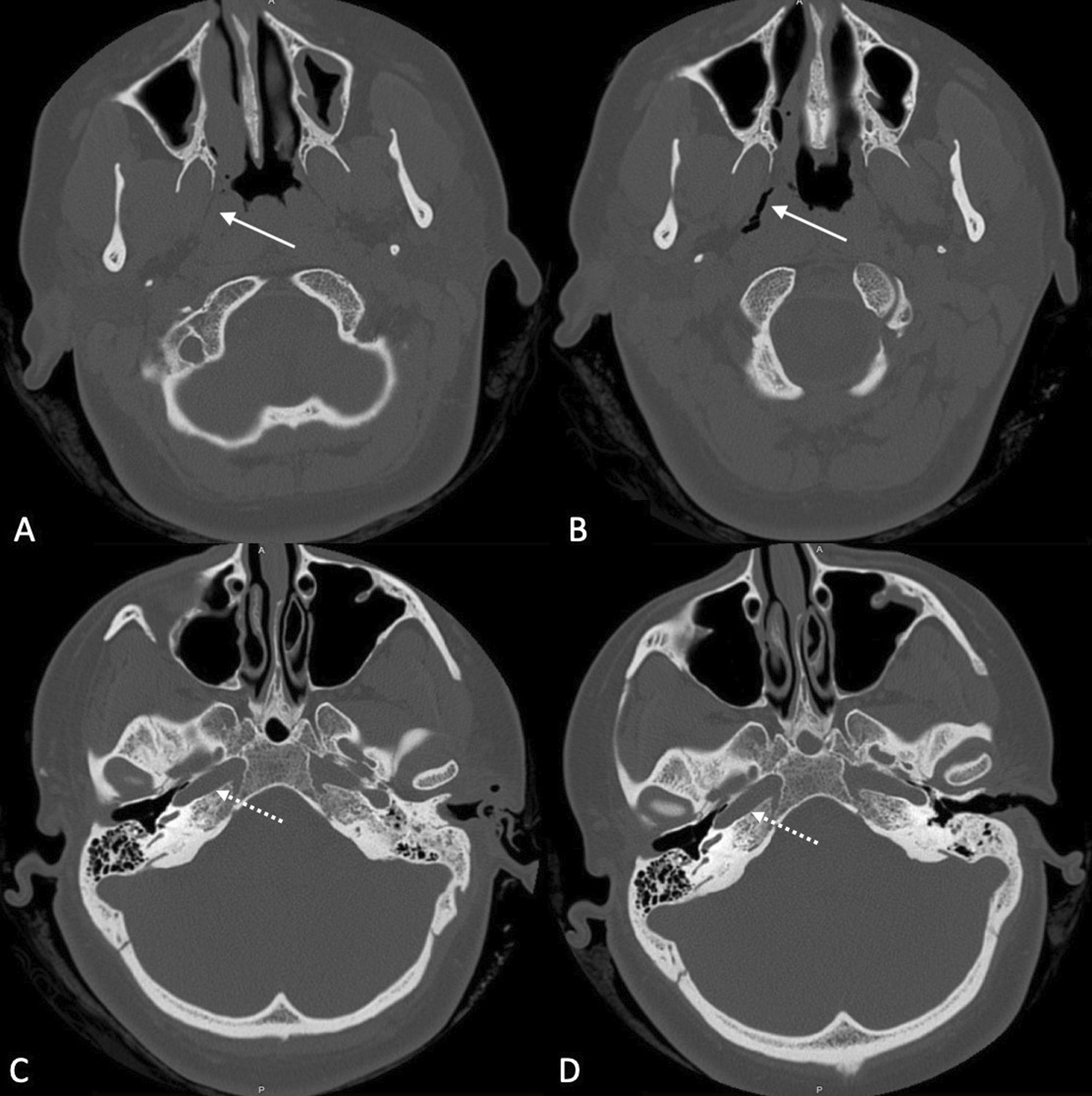 Fig. 4