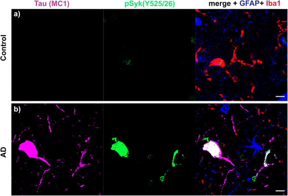 Fig. 16