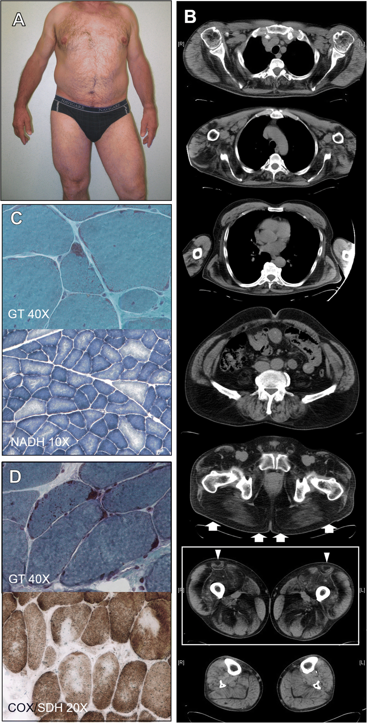 Fig. 1