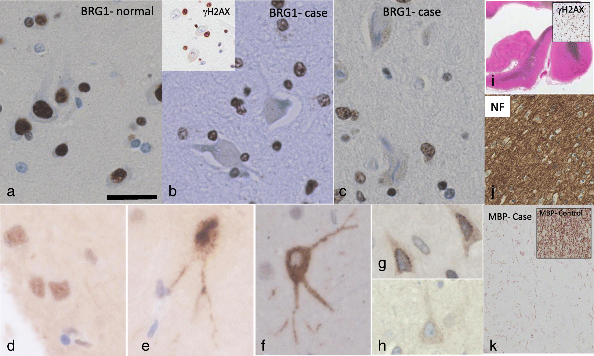 Fig. 12