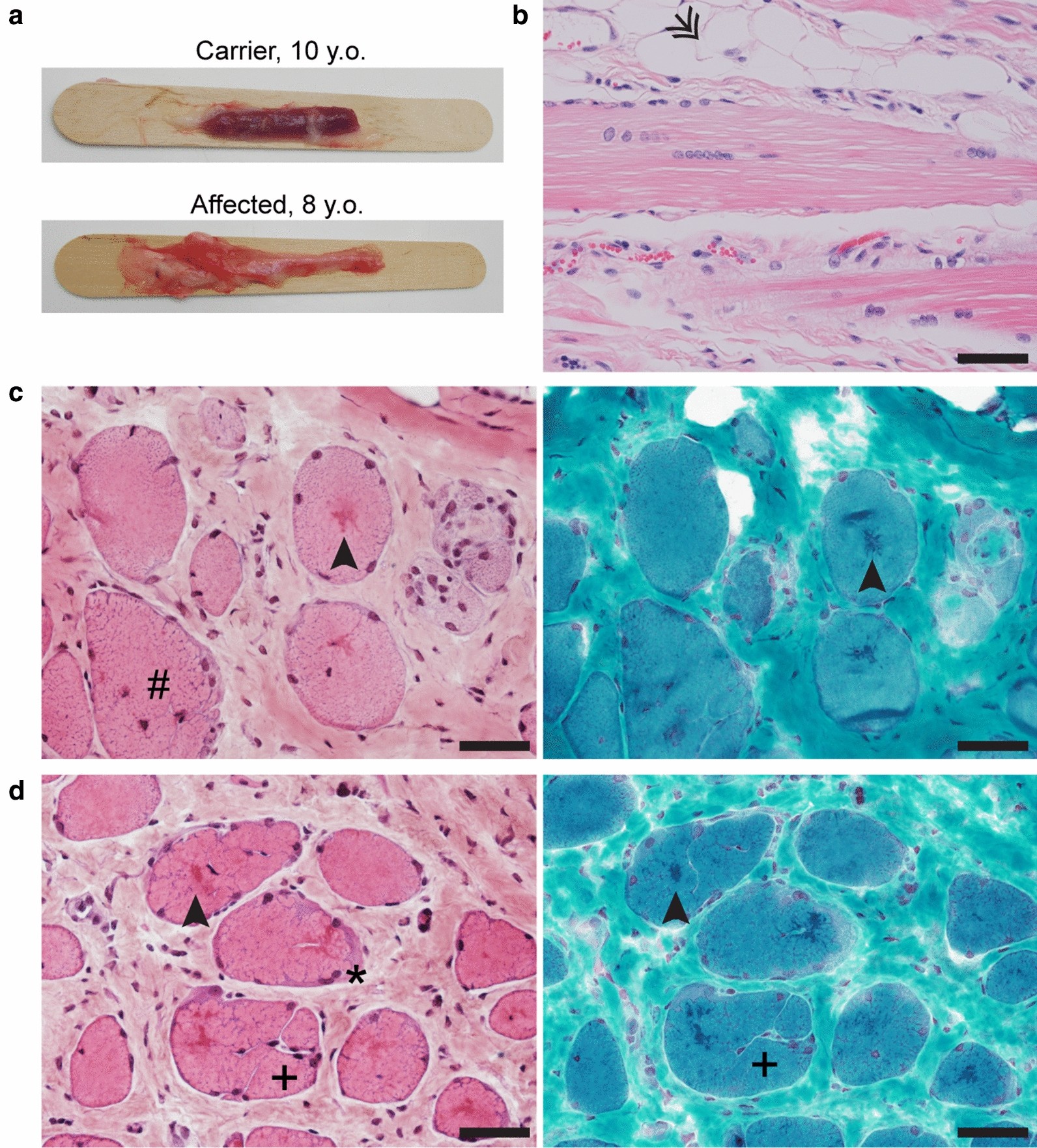 Fig. 1