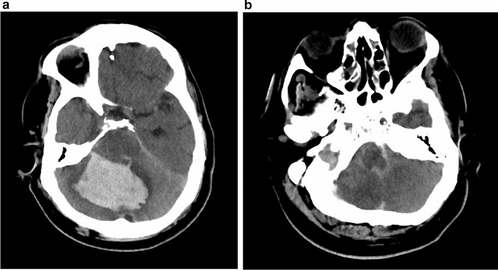 Fig. 1