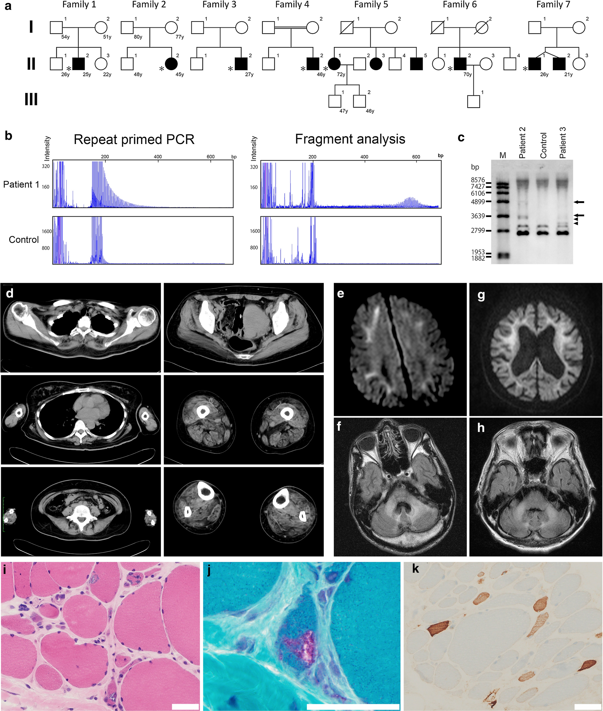 Fig. 1