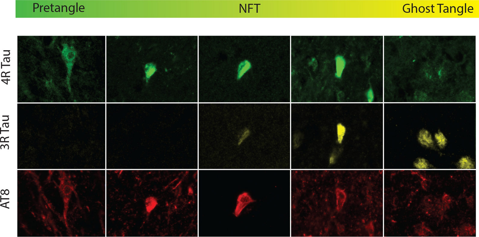 Fig. 11