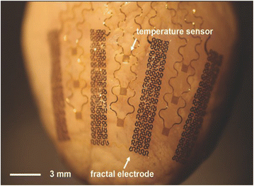 Fig. 4