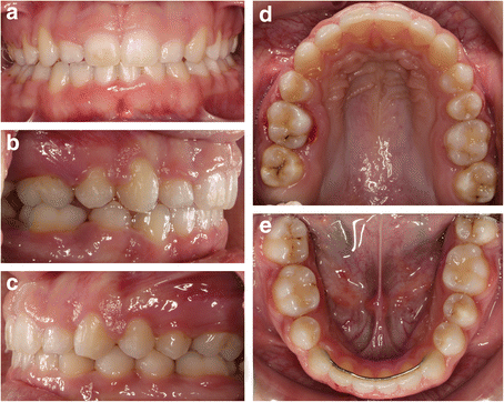 Fig. 8