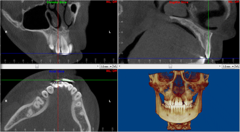 Fig. 6