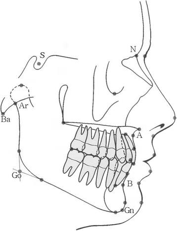 Fig. 1