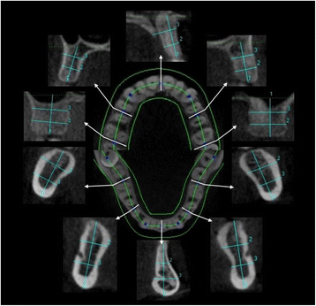 Fig. 2