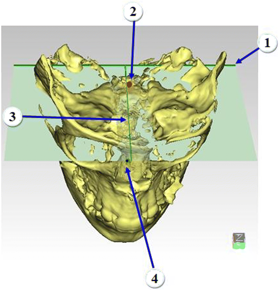 Fig. 2