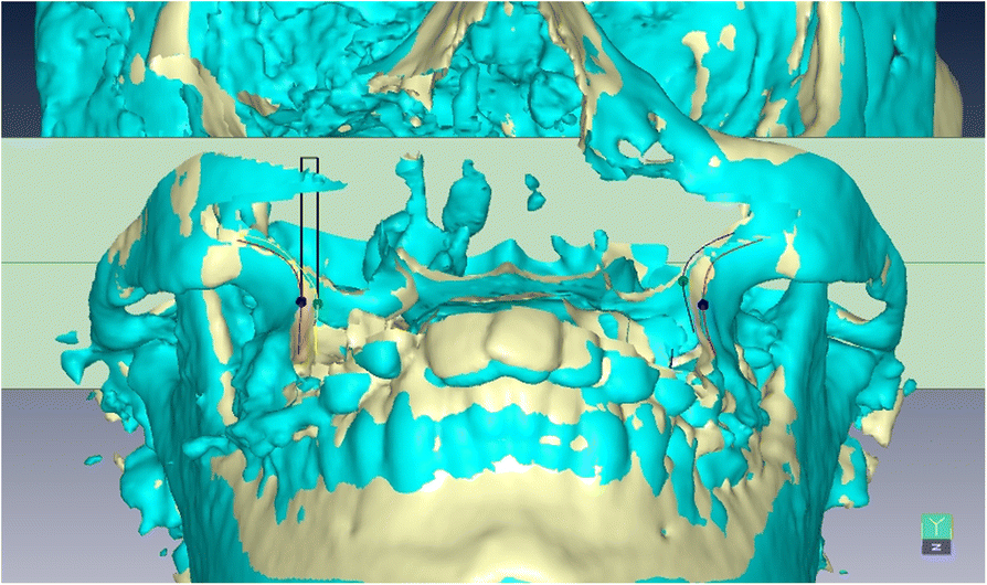 Fig. 4