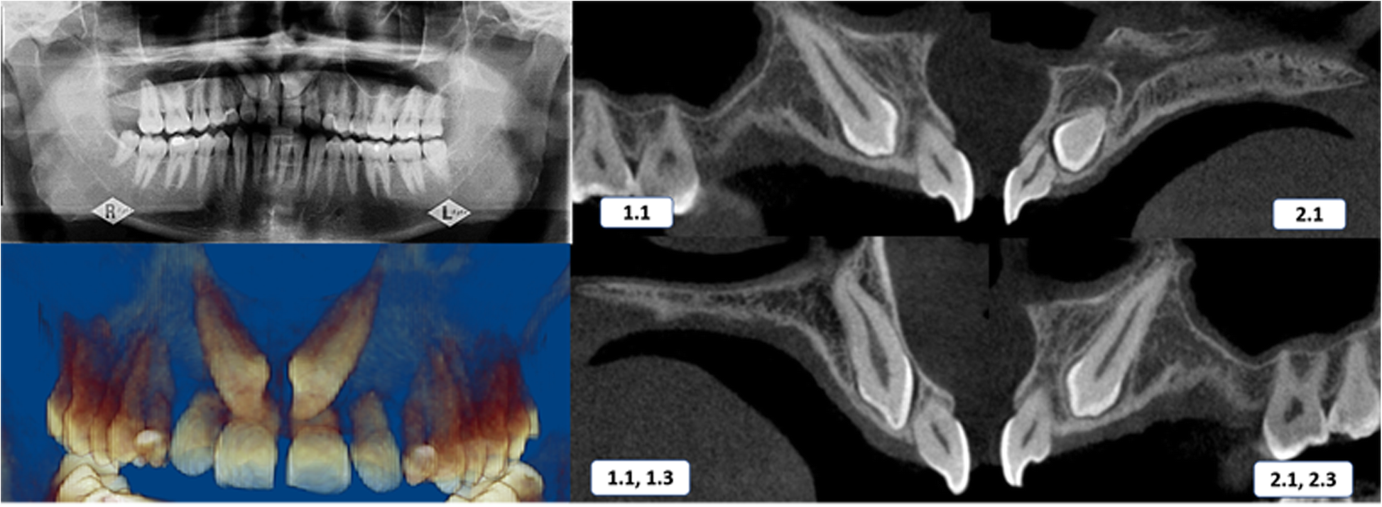 Fig. 2