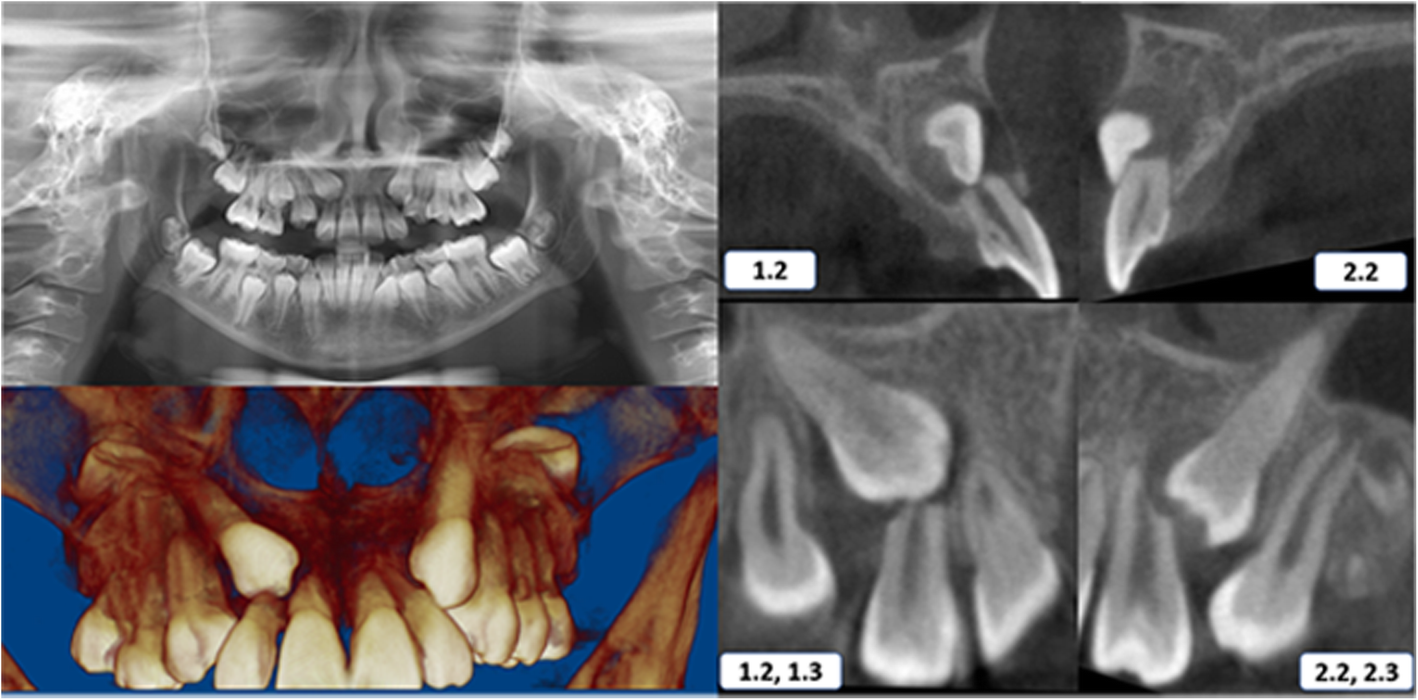 Fig. 3