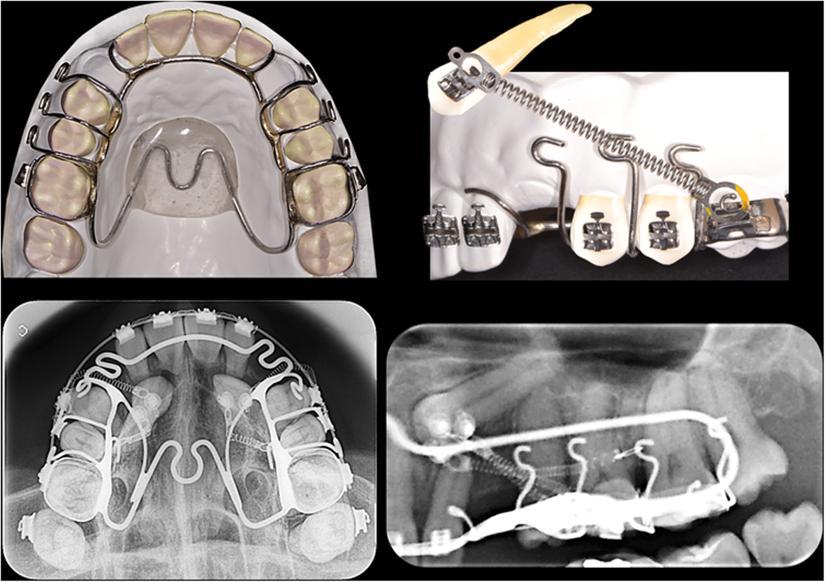 Fig. 4