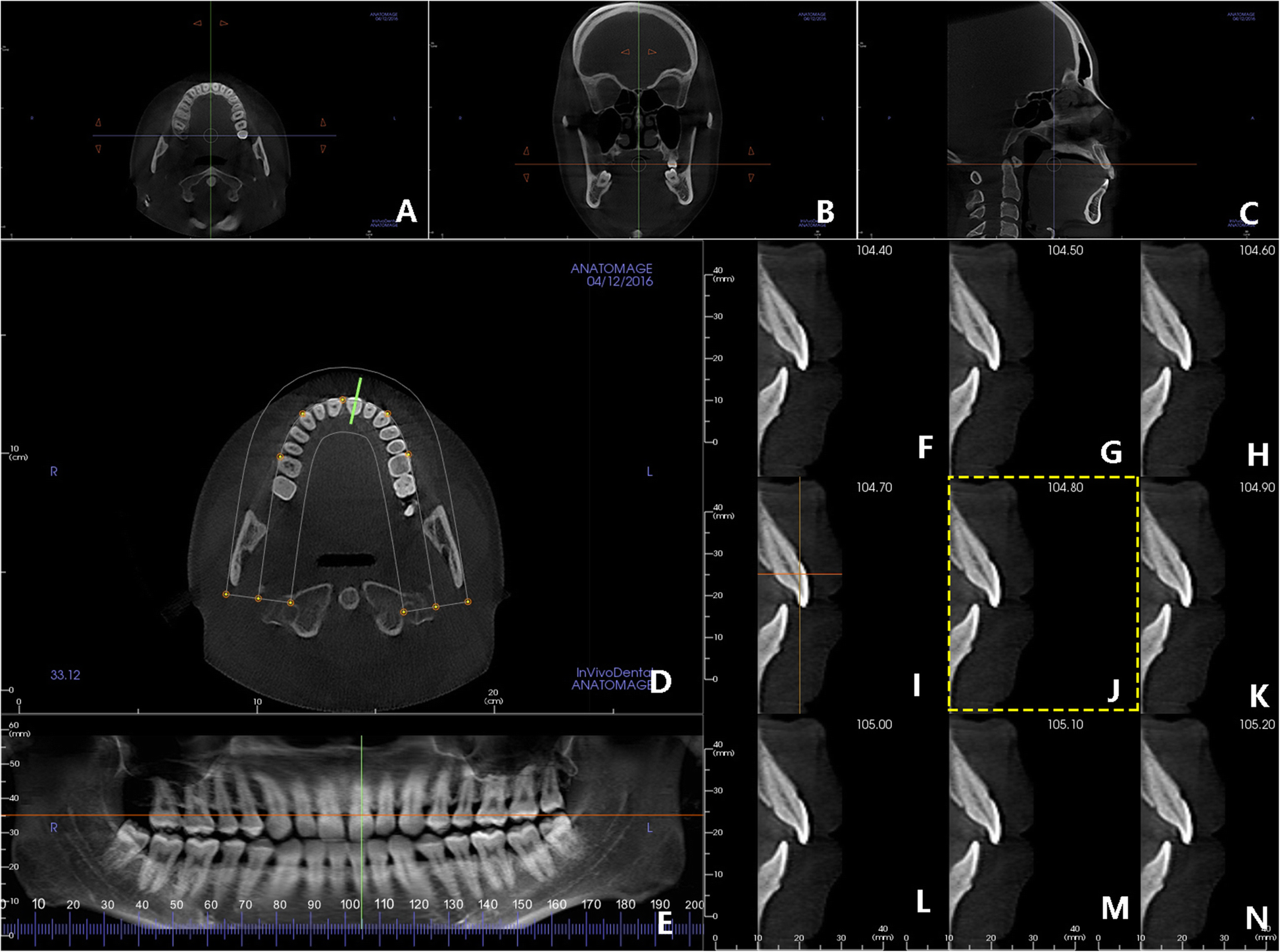 Fig. 3