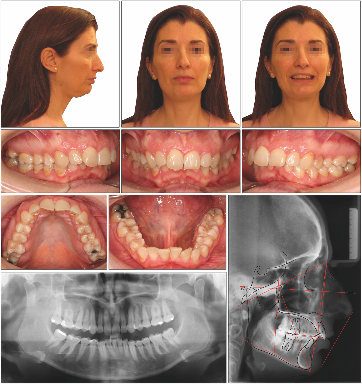 Fig. 1