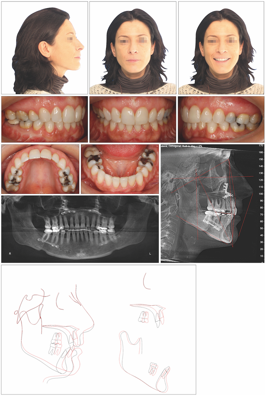 Fig. 6