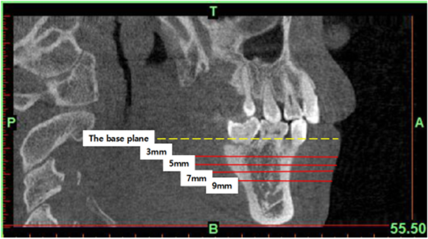 Fig. 3