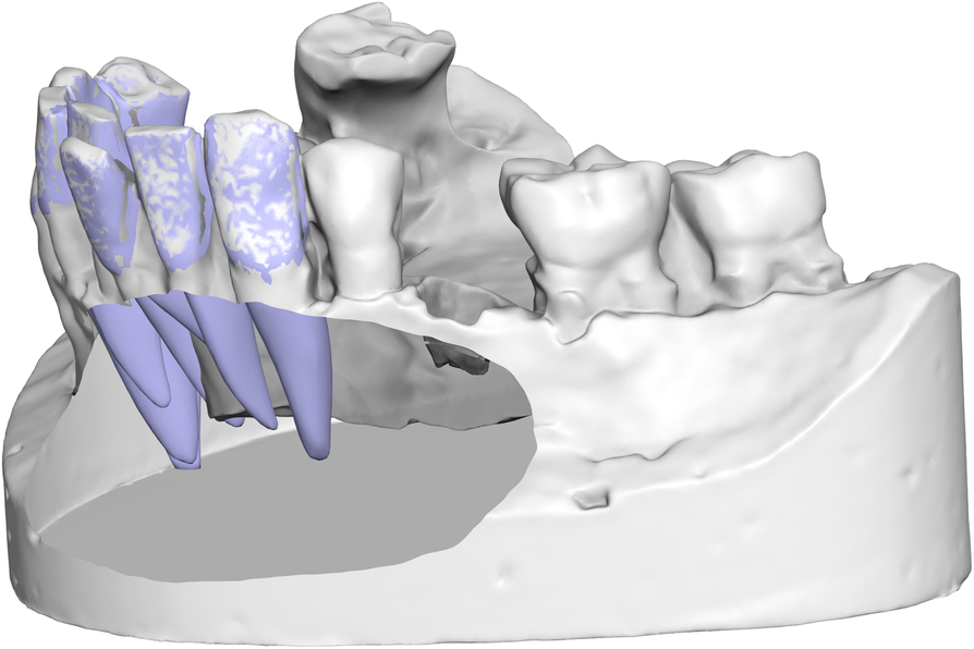 Fig. 3