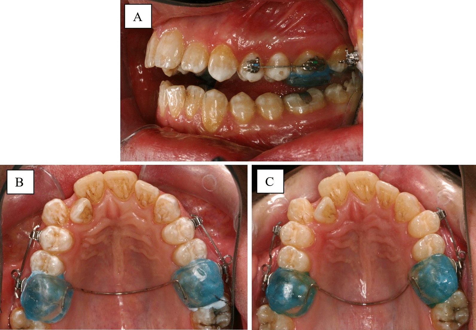 Fig. 2