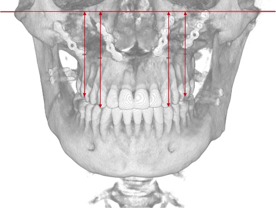 Fig. 8