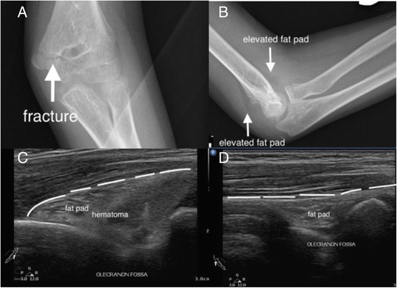 Fig. 9