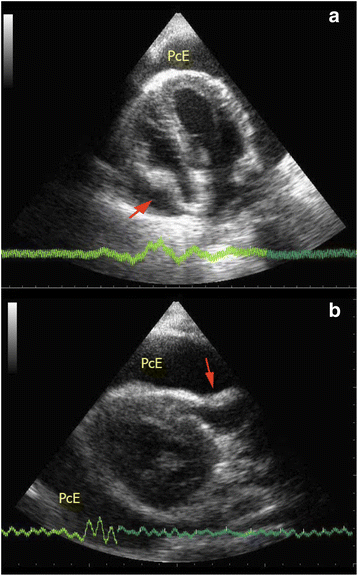 Fig. 14