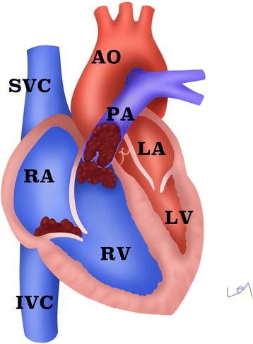 Fig. 2