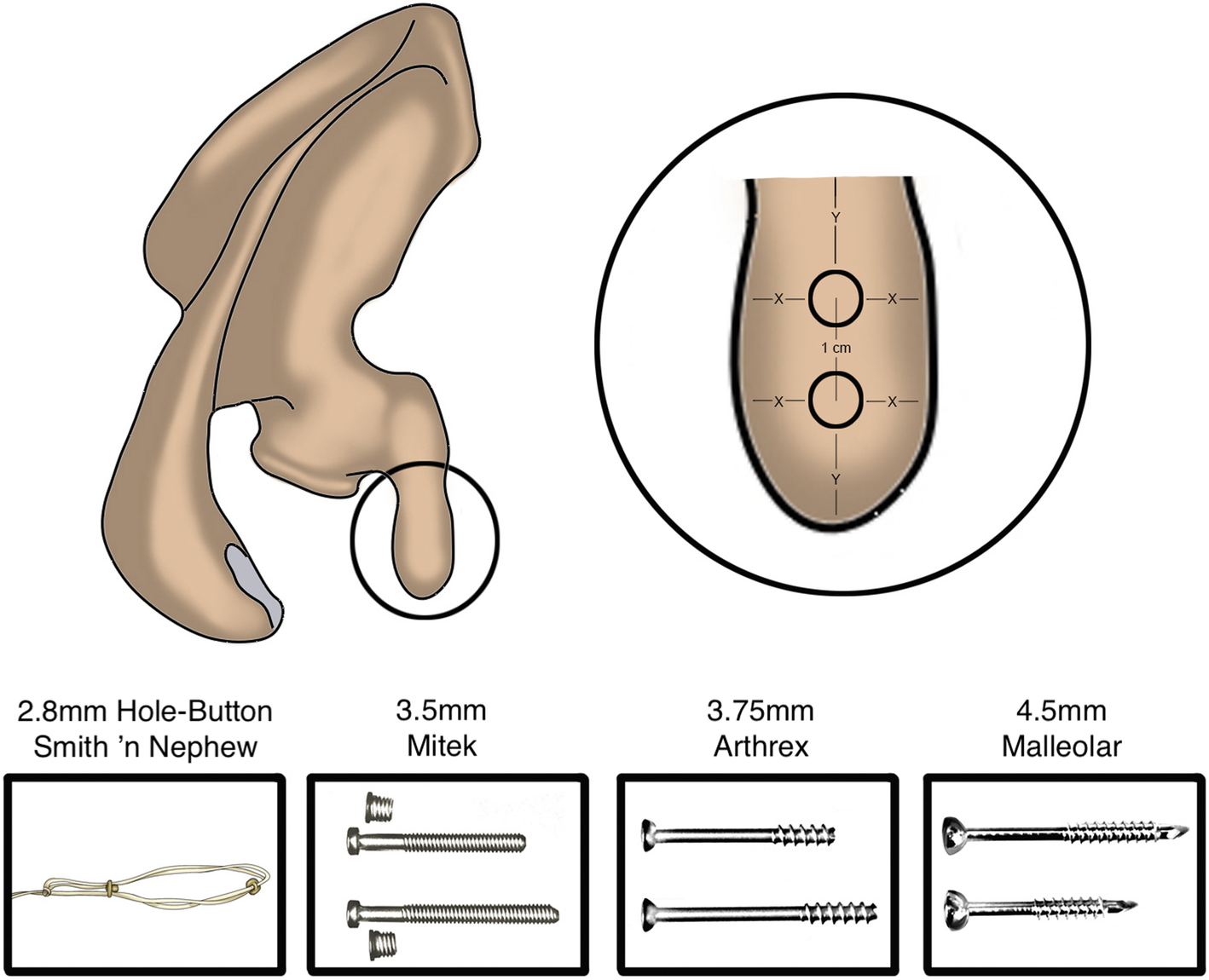 Fig. 4