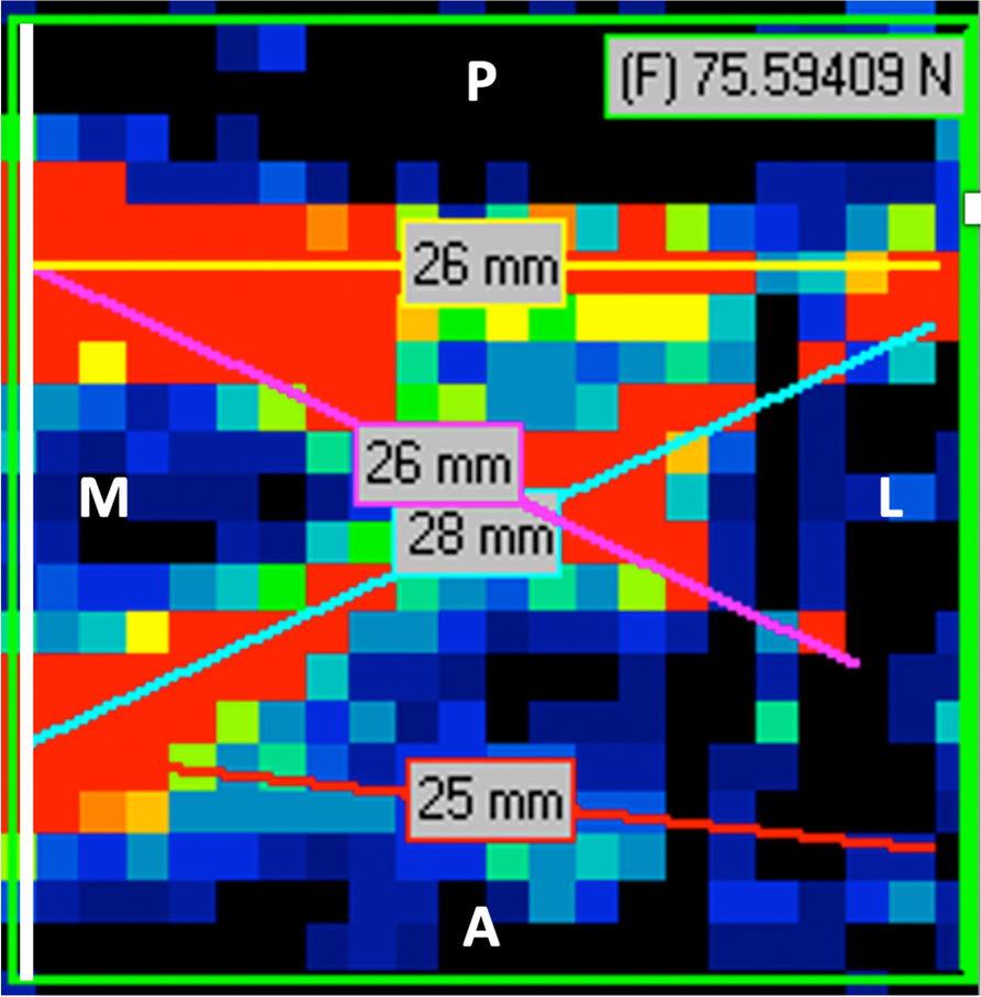 Fig. 4