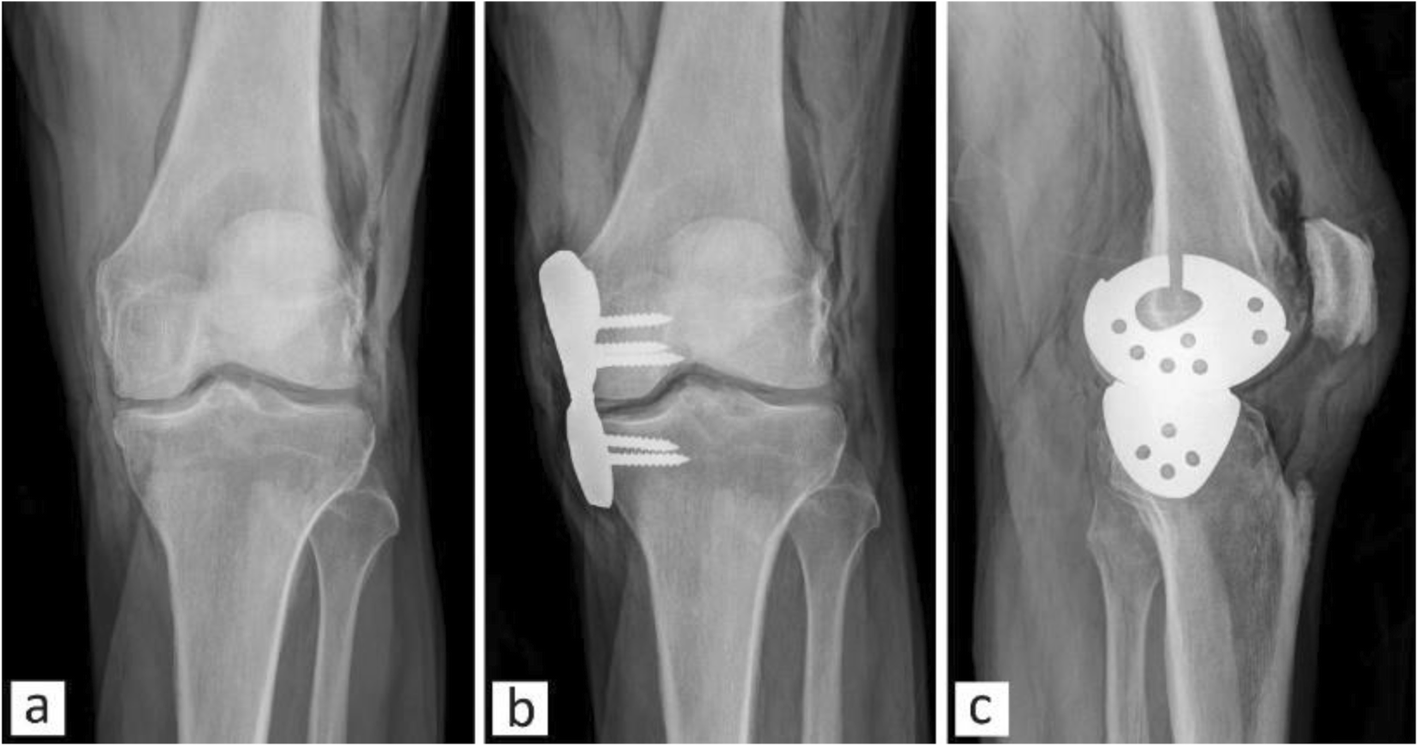 Fig. 11