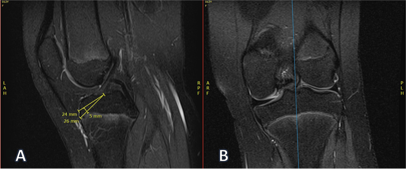 Fig. 5