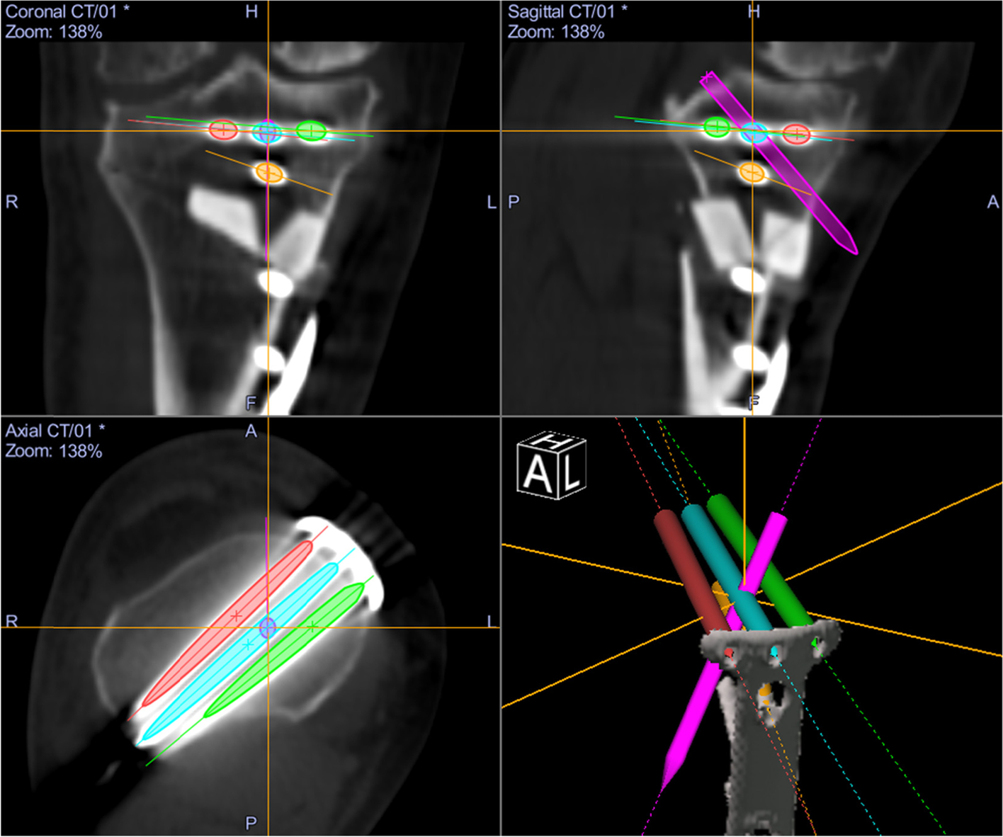 Fig. 4