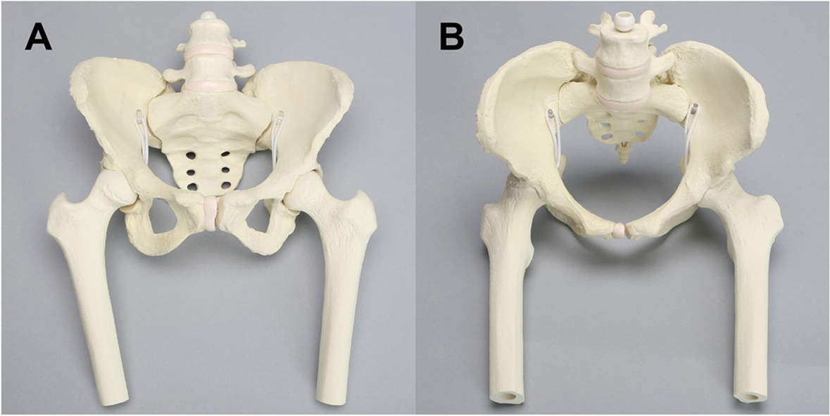 Fig. 1