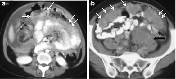 Fig. 5