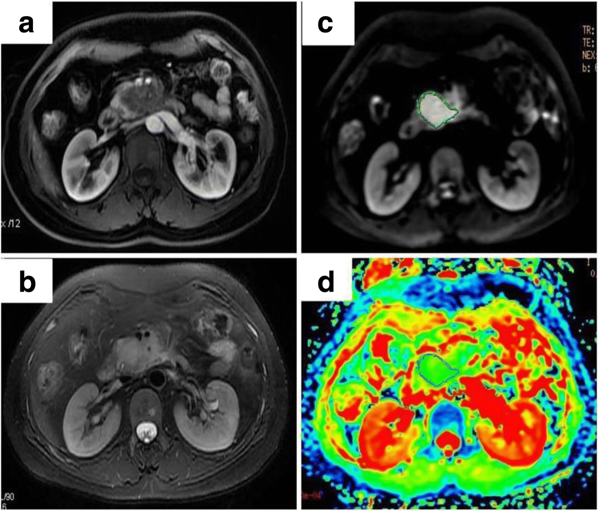 Fig. 1