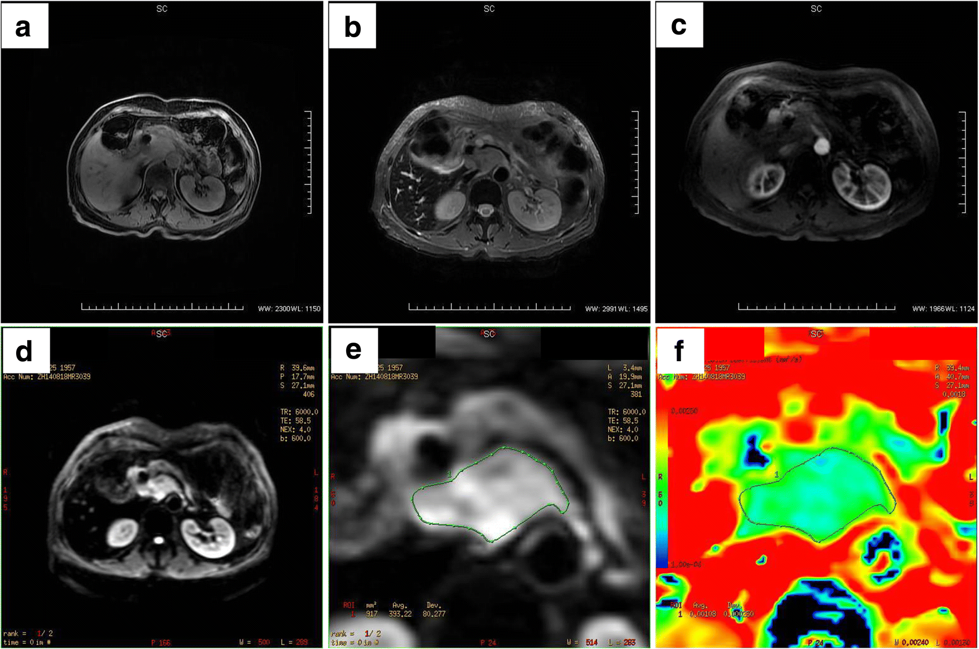 Fig. 6