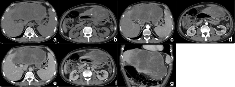 Fig. 5