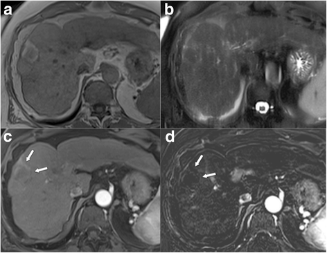 Fig. 14