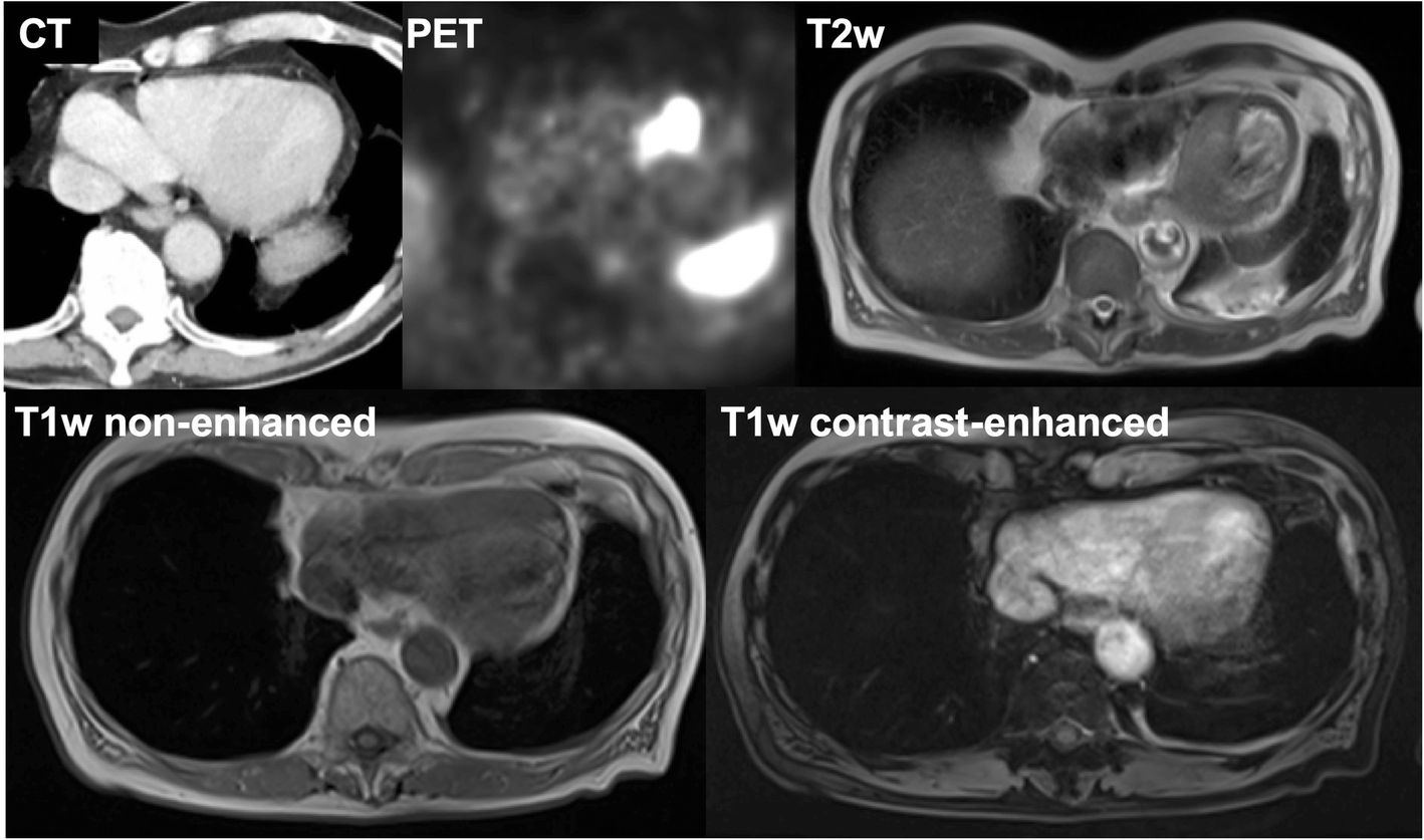 Fig. 3