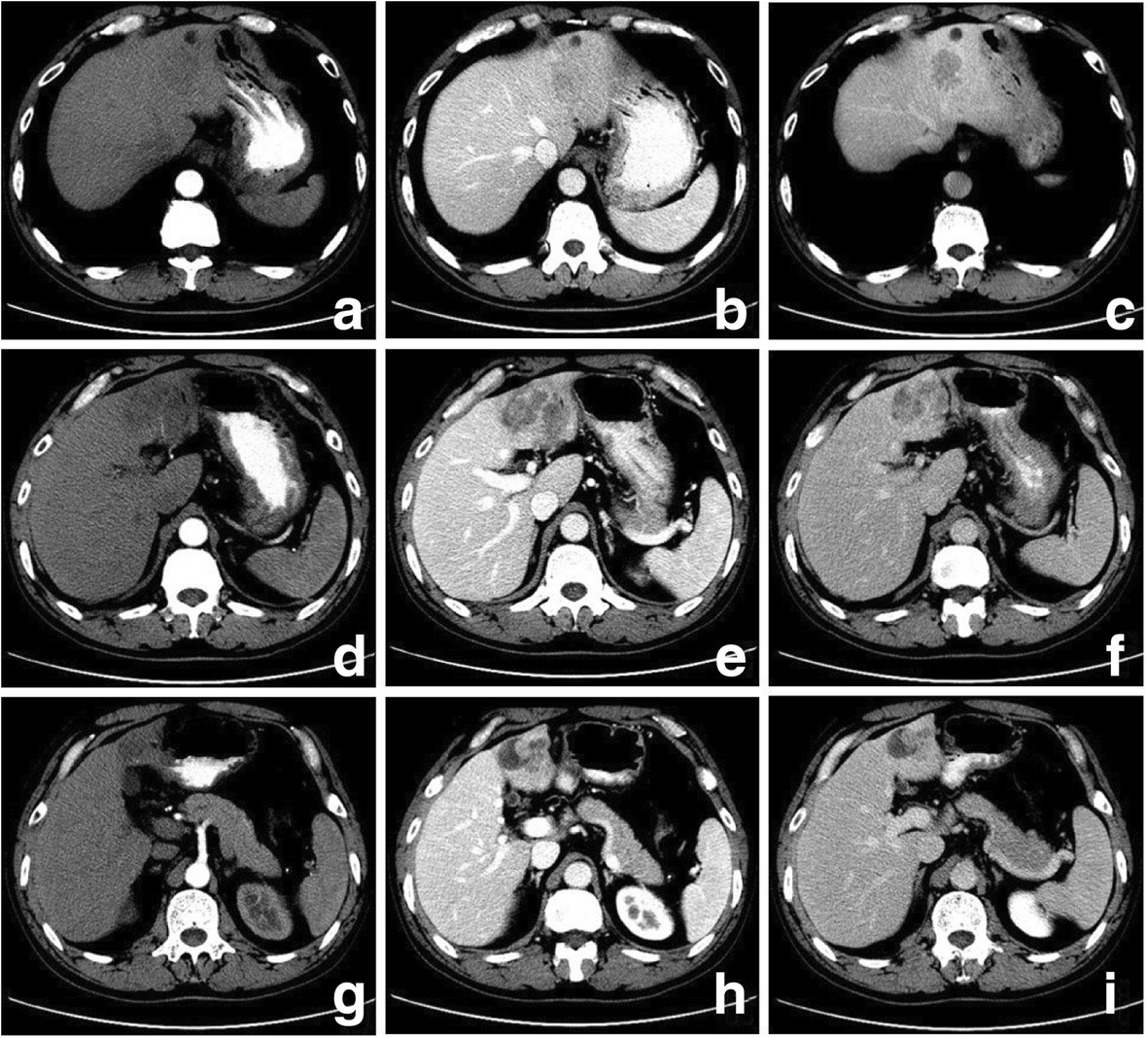 Fig. 6