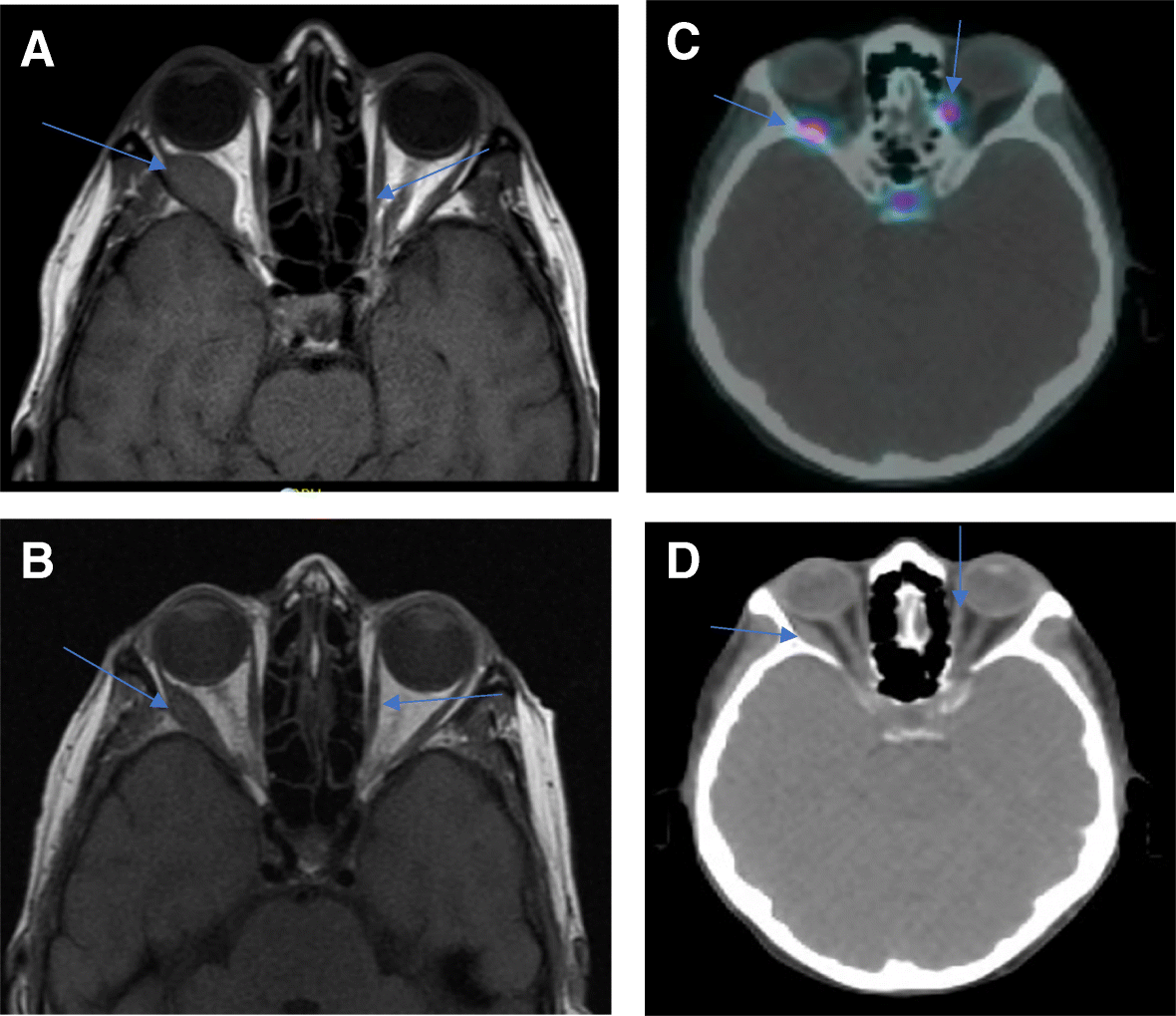 Fig. 5