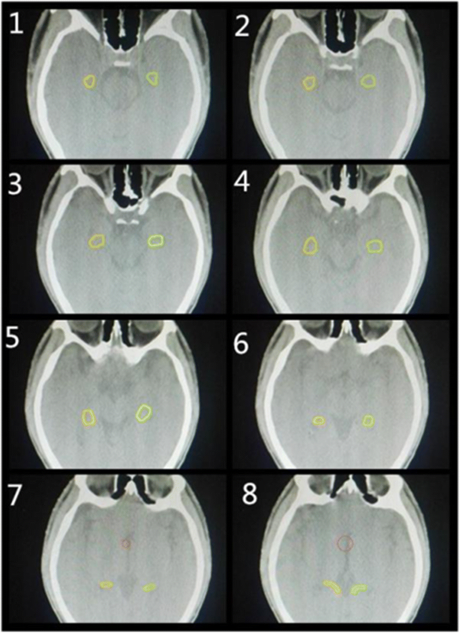 Fig. 1