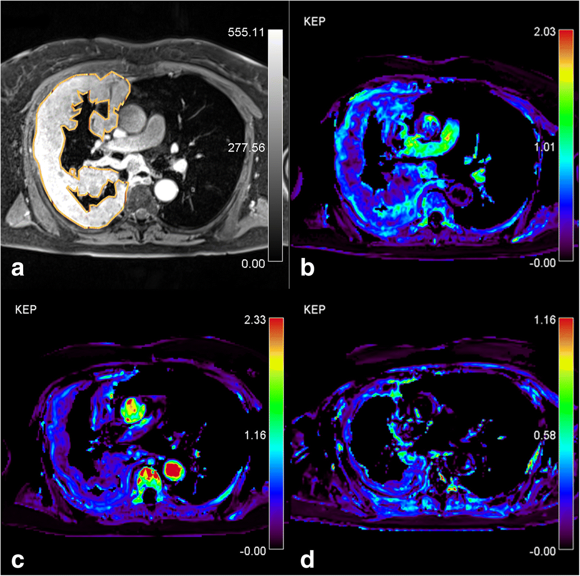 Fig. 4