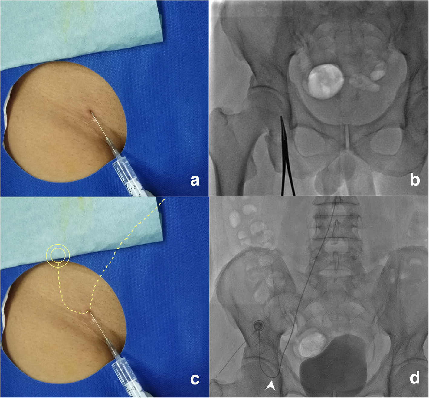 Fig. 2