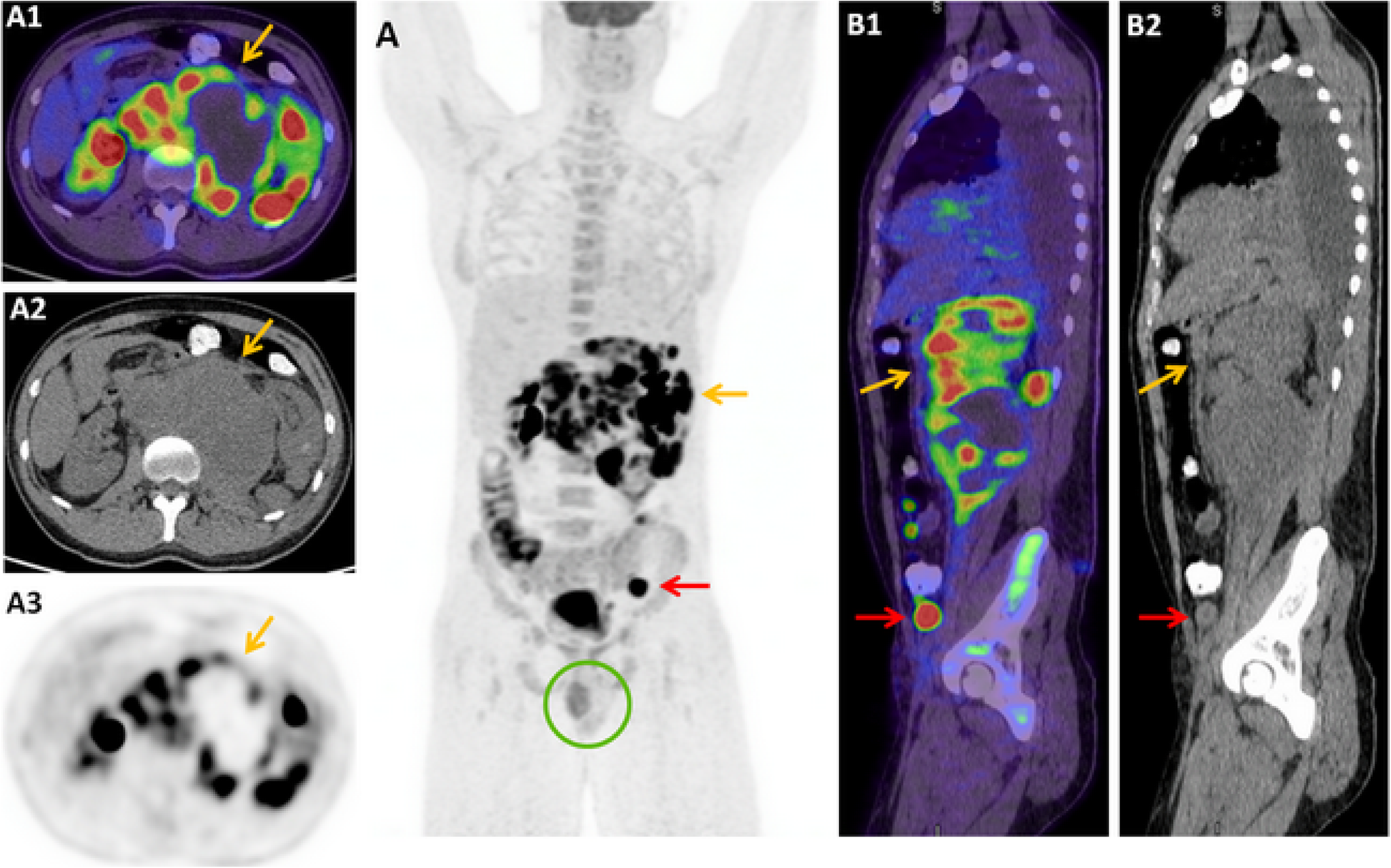 Fig. 1