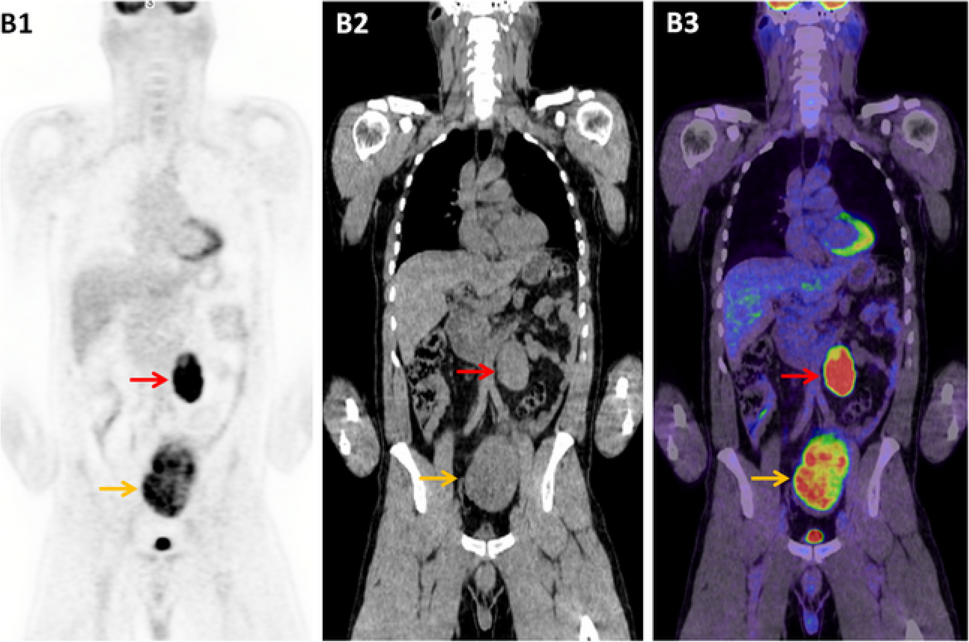 Fig. 3