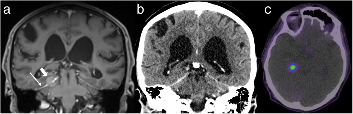 Fig. 10